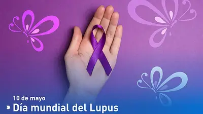 El 10 de mayo es el Día Mundial del Lupus El 10 de mayo es el Día Mundial del Lupus