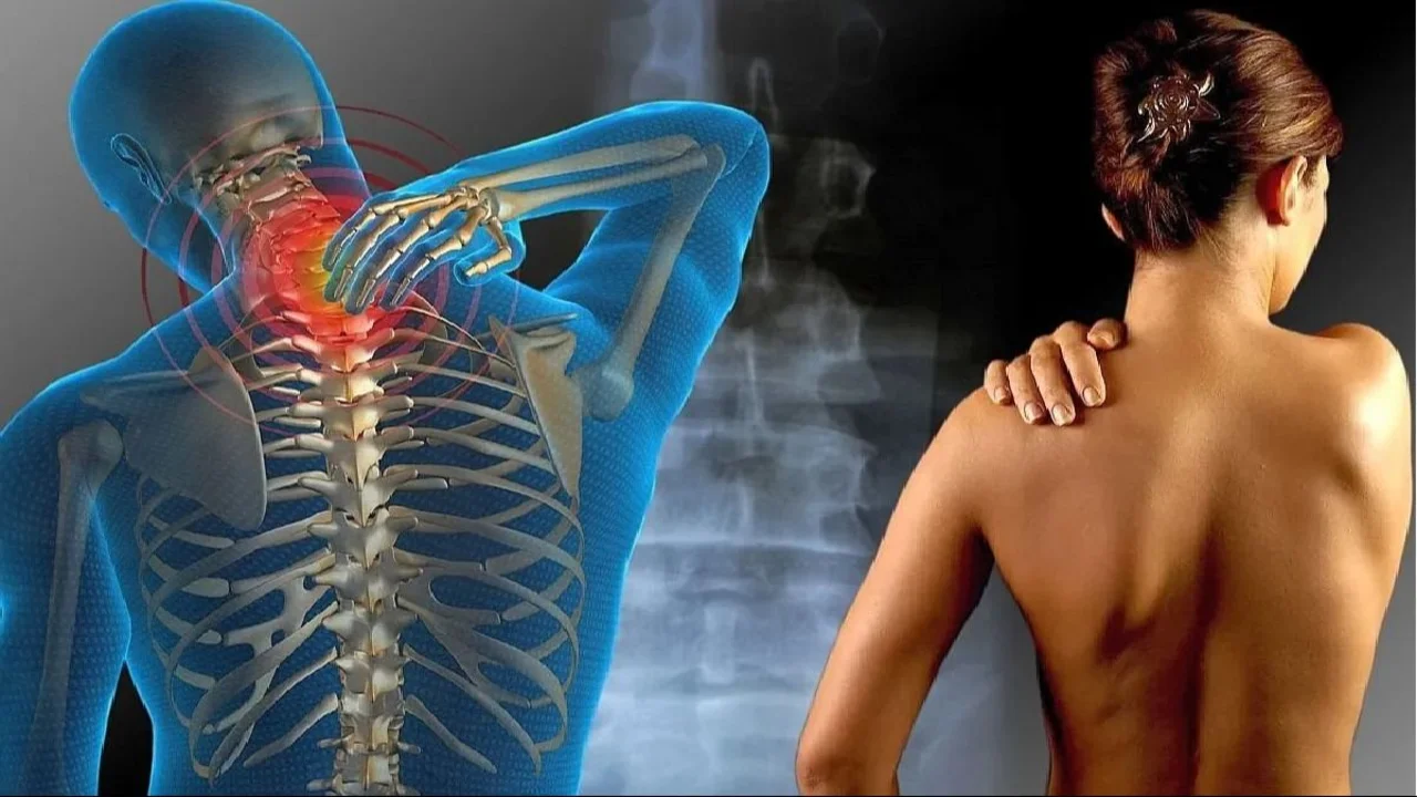 Fibromialgia