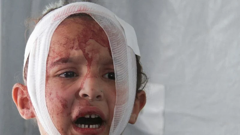 ONU dice muertos en Gaza superan los 35.000, pero no todos han sido identificados