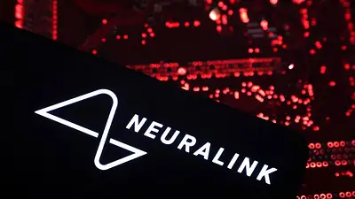 La FDA autoriza el implante de un chip cerebral de Neuralink en un segundo paciente: WSJ La FDA autoriza el implante de un chip cerebral de Neuralink en un segundo paciente: WSJ