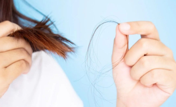 Caída del pelo en otoño: la guía rápida para saber si es normal o se necesita tratamiento | Otoño