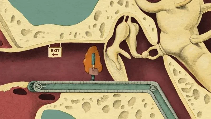 Enfermedad que se puede detectar con la cera de oídos cerumen
