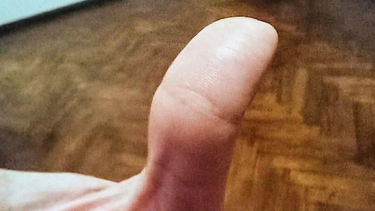 El "Ojo de Buda" es la marca que pocas personas tienen en su dedo pulgar