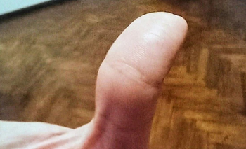 El "Ojo de Buda" es la marca que pocas personas tienen en su dedo pulgar | Mano