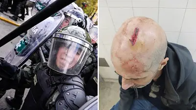 Marcha de jubilados: los brutales ataques de las fuerzas contra la prensa y manifestantes Marcha de jubilados: los brutales ataques de las fuerzas contra la prensa y manifestantes