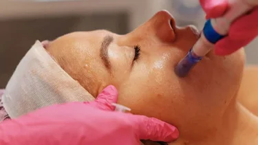 El bioestimulador  es el nuevo retoque estético que se hacen las famosas de Hollywood