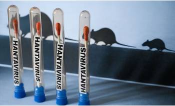De Nueva York a Buenos Aires: el nuevo laboratorio que busca acorralar al hantavirus | Salud