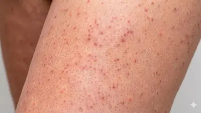 Piel de fresa Piel de fresa