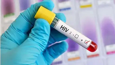 Alerta en La Rioja: denuncian que el recorte de Milei pone en riesgo tratamientos de VIH en la provincia Alerta en La Rioja: denuncian que el recorte de Milei pone en riesgo tratamientos de VIH en la provincia