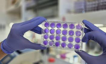 El dengue, el zika y la fiebre amarilla comparten el mismo mecanismo de replicación | Ciencia 