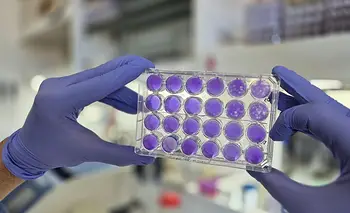 El dengue, el zika y la fiebre amarilla comparten el mismo mecanismo de replicación | Ciencia 