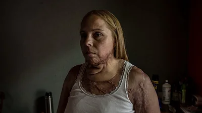 Karina Abregú: "El Estado no me ayuda en nada, ni siquiera me paga los medicamentos" Karina Abregú: "El Estado no me ayuda en nada, ni siquiera me paga los medicamentos"