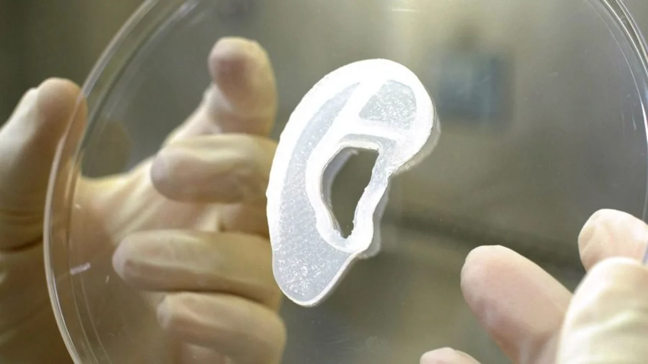 Trasplantan por primera vez una oreja 3D hecha con células humanas