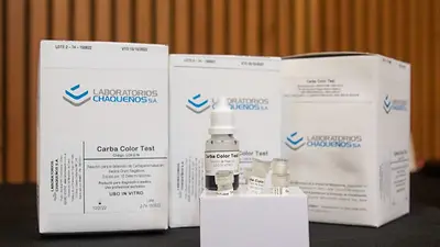 Se podrá detectar cuando las bacterias resisten a los antibióticos: en qué consiste Se podrá detectar cuando las bacterias resisten a los antibióticos: en qué consiste