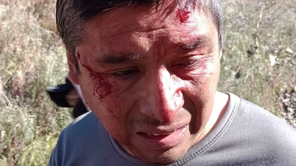Las imágenes del horror en Jujuy: Morales reprime y denuncian decenas de detenidos