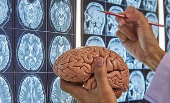 Alerta: un famoso fármaco aumenta un 33% el riesgo de demencia | Consejos de salud