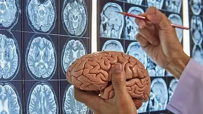 Médico que analiza el cerebro. Médico que analiza el cerebro.