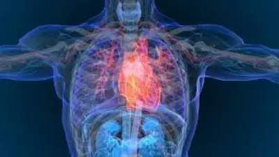 Qué es la Amiloidosis Hereditaria por Transtiretina: síntomas y tratamiento. Qué es la Amiloidosis Hereditaria por Transtiretina: síntomas y tratamiento.