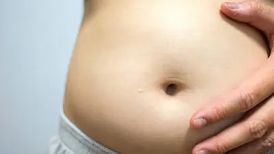 Inflamación intestinal Inflamación intestinal