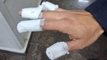Córdoba: tres adolescentes prendieron fuego a un policía con una bomba molotov y fueron detenidos