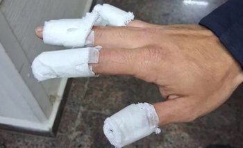 Tres adolescentes quemaron a un policía con una bomba molotov | Violencia