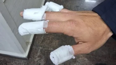 Córdoba: tres adolescentes prendieron fuego a un policía con una bomba molotov y fueron detenidos