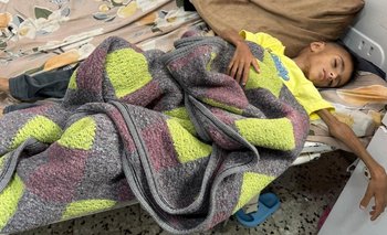Gaza: un padre denunció que su hija de 2 años murió por desnutrición | Conflicto en medio oriente