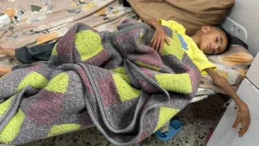 Gaza: un padre denunció que su hija de 2 años murió por desnutrición