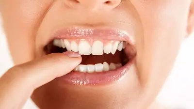 dientes, dientes flojos, consejos, salud bucal dientes, dientes flojos, consejos, salud bucal