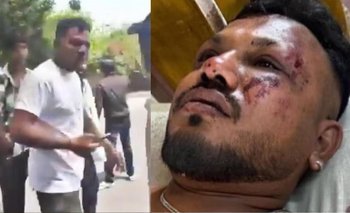 Milagro: salió caminando el único sobreviviente del avión estrellado en India  | Accidente aéreo