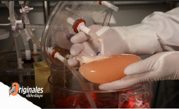 Hito: por primera vez, tratan a un paciente con un hígado fabricado en el laboratorio | Ciencia 
