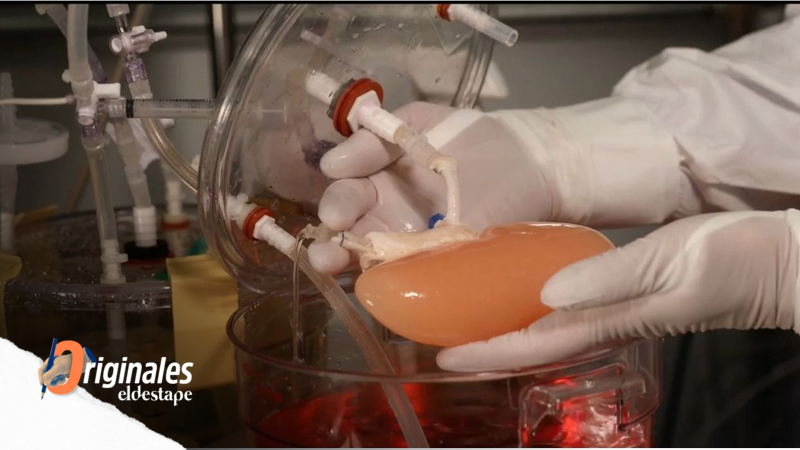 Hito: por primera vez, tratan a un paciente con un hígado fabricado en el laboratorio