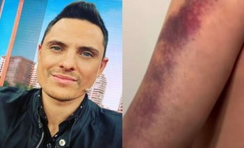 Susto en el mundo de la televisión por lo que le pasó a Lío Pecoraro | Televisión 