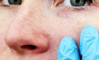 Alerta: seis hábitos para cuidarse la piel del frío extremo | Consejos de salud