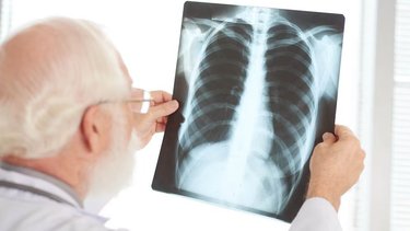 Alerta en Argentina: aumentaron un 38% los casos de tuberculosis