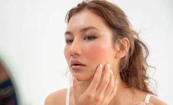 La "cara de alergia" en otoño es real: trucos para combatirla | Moda