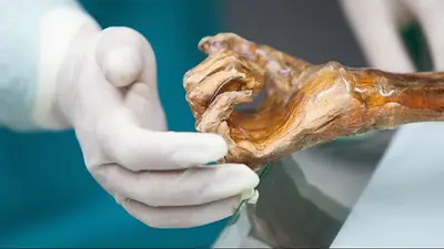 Encontraron indicios de vida en Ötzi, el "hombre de las nieves" con más de 5000 años de edad Encontraron indicios de vida en Ötzi, el "hombre de las nieves" con más de 5000 años de edad