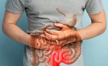 La enfermedad inflamatoria intestinal avanza en silencio | Salud