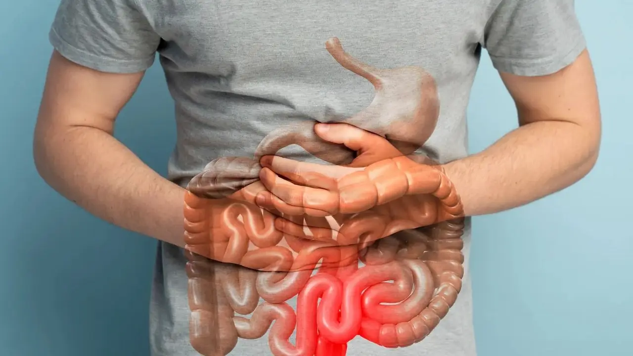 La enfermedad inflamatoria intestinal avanza en silencio: cuáles son las señales de alerta