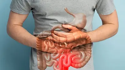 La enfermedad inflamatoria intestinal avanza en silencio: cuáles son las señales de alerta La enfermedad inflamatoria intestinal avanza en silencio: cuáles son las señales de alerta