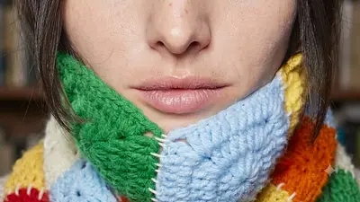 Labios resecos por el frío Labios resecos por el frío