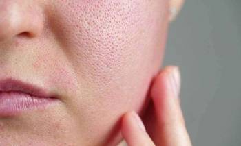 Chau poros abiertos: mascarilla casera con 3 ingredientes | Belleza