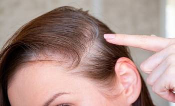 Chau pelo finito y en poca cantidad: el hábito para engrosarlo | Belleza