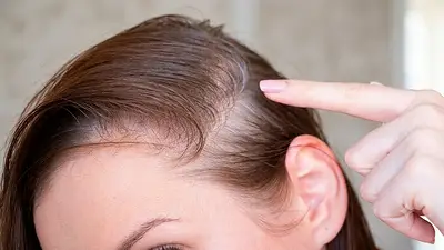 Cabello Cabello