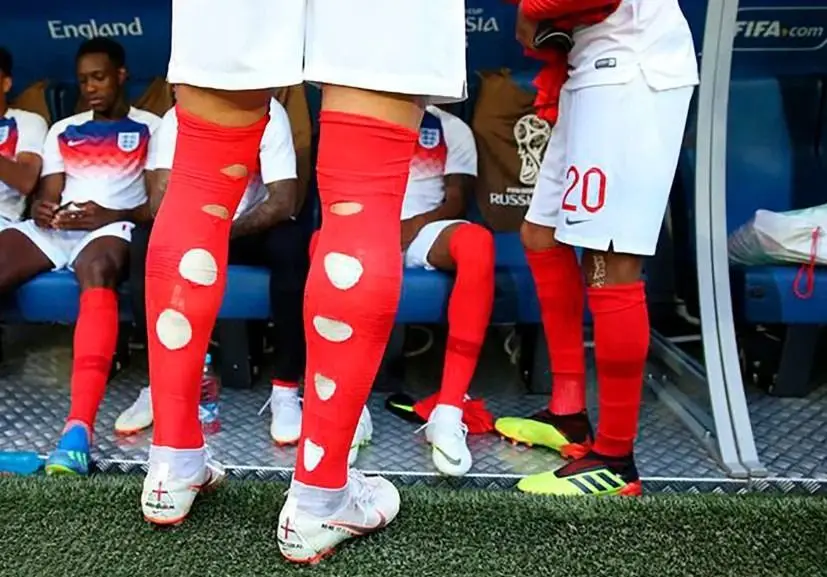 Jugadores con medias rotas.
