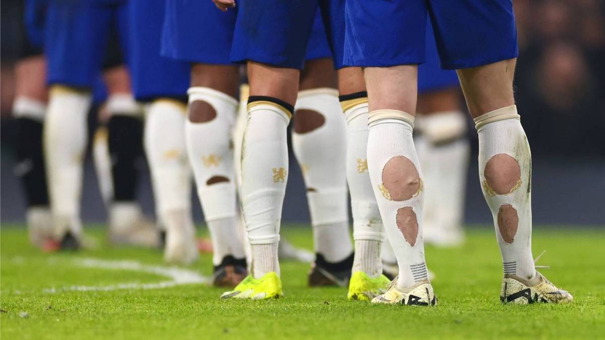 Por qué muchos jugadores de fútbol tienen las medias rotas o cortadas en los partidos del Mundial 2026