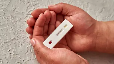 Crece el diagnóstico tardío de VIH: 1 de cada 2 argentinos se entera tarde Crece el diagnóstico tardío de VIH: 1 de cada 2 argentinos se entera tarde