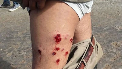 La policía de Gerardo Morales reprimió una protesta de trabajadores de Ledesma La policía de Gerardo Morales reprimió una protesta de trabajadores de Ledesma