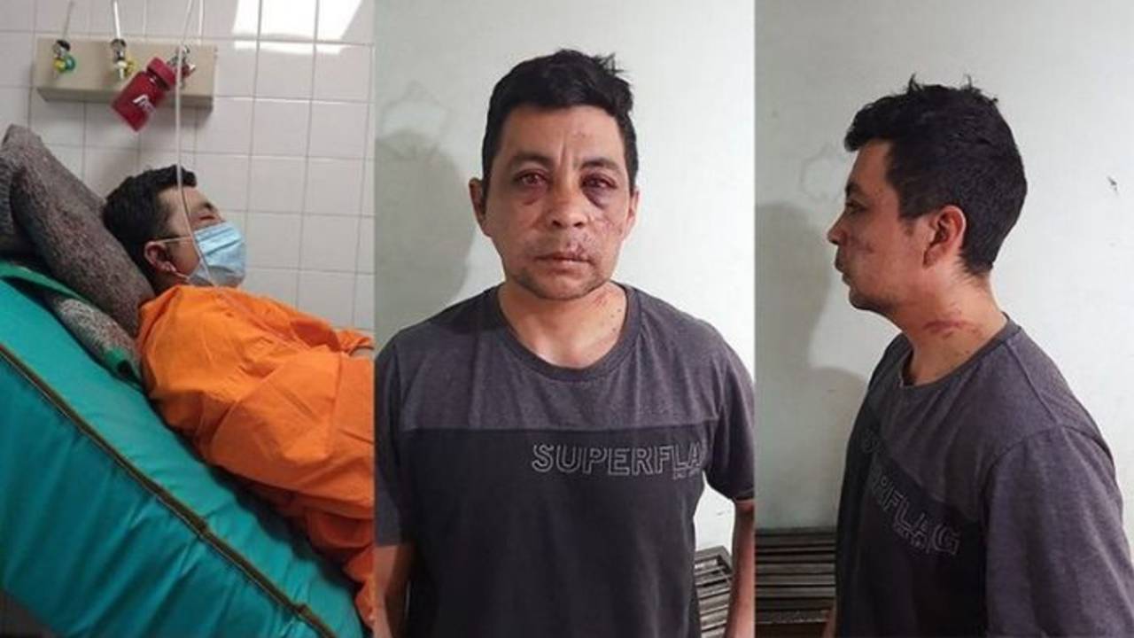 Es enfermero, tiene coronavirus y sus vecinos lo golpearon y le prendieron fuego la casa