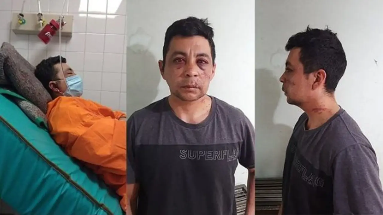 Es enfermero, tiene coronavirus y sus vecinos lo golpearon y le prendieron fuego la casa